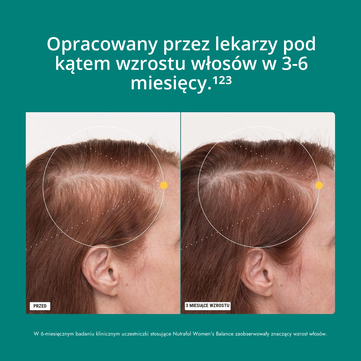 Nutrafol dla kobiet 45+ (120 kapsułek)