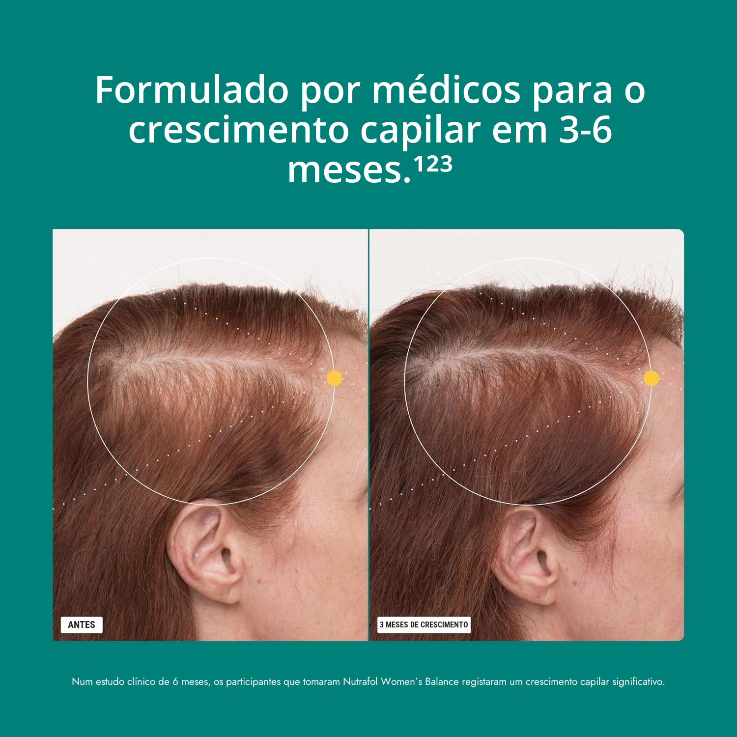 Nutrafol para Mulher 45+ (120 Cápsulas)