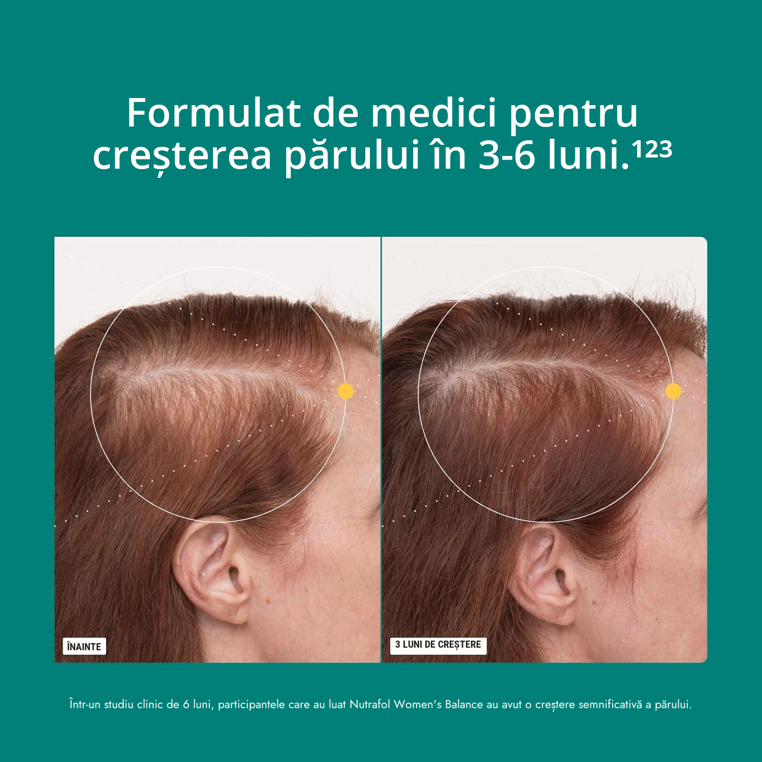 Nutrafol pentru femei 45+ (120 capsule)