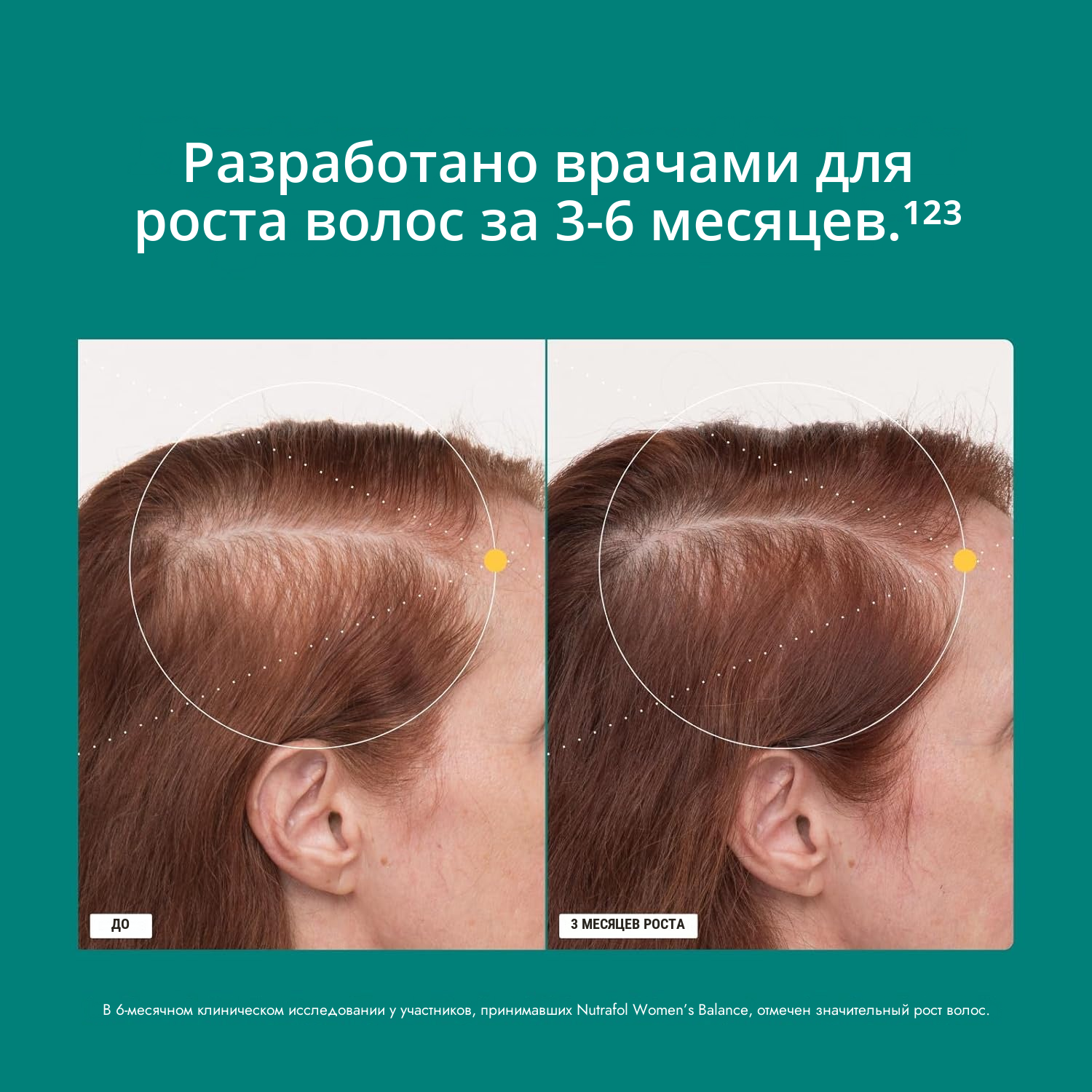 Nutrafol для женщин 45+ (120 капсул)