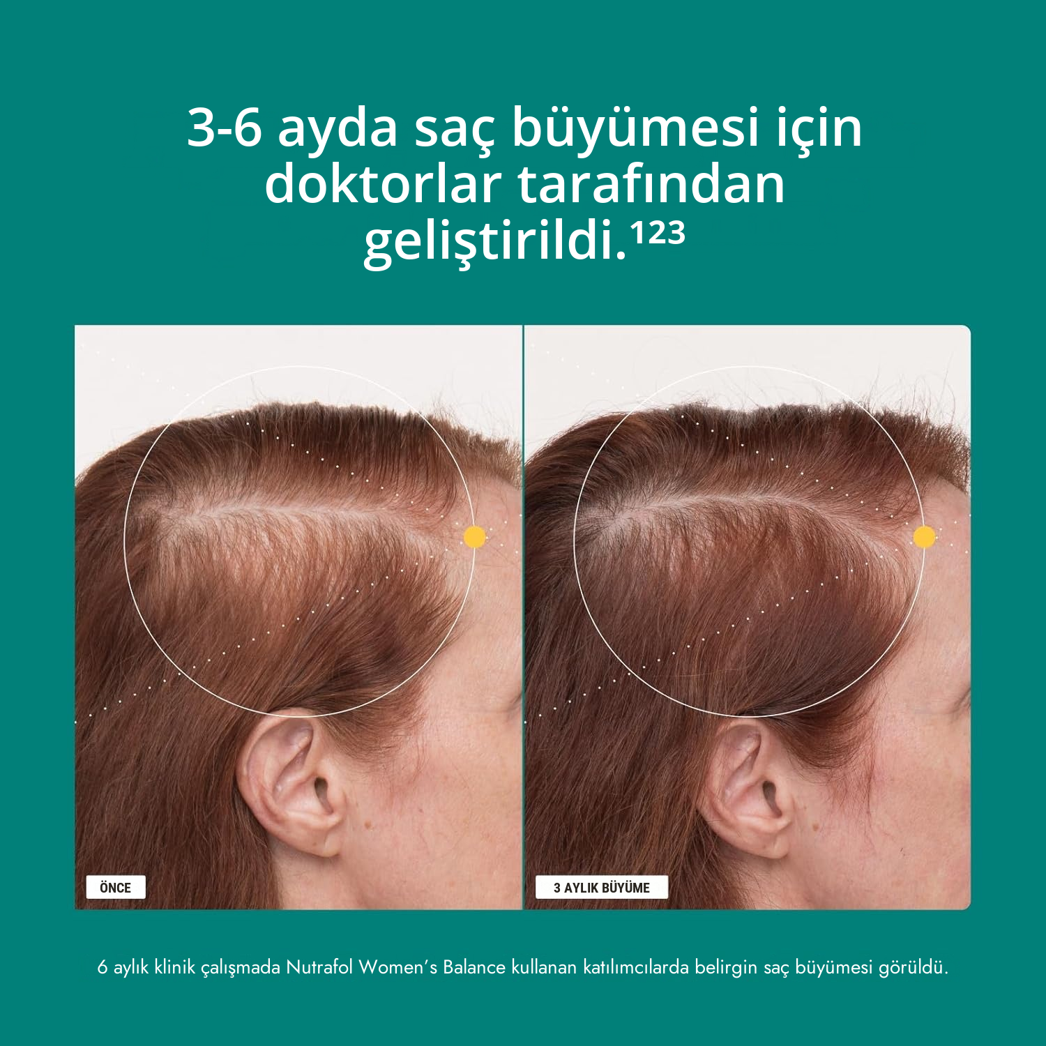 Nutrafol Kadınlar İçin 45+ (120 Kapsül)