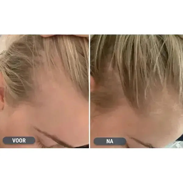 Regaine Foam 5% for Women (4-Month Supply)