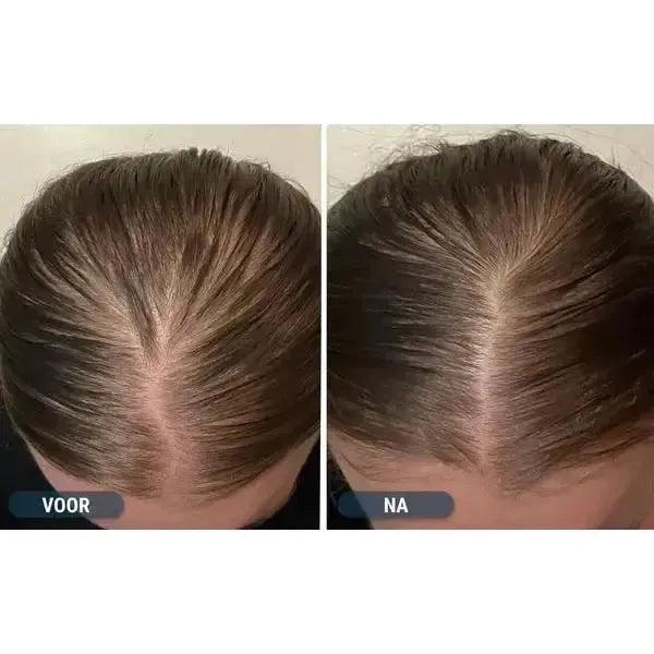 Regaine Foam 5% for Women (4-Month Supply)