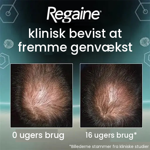 Regaine minoxidil-skum 5% til mænd