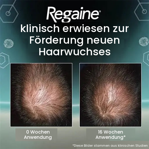 Regaine Minoxidil Schaum 5% für Männer