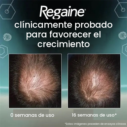 Regaine Espuma de Minoxidil 5% para Hombres – Suministro para 6 Meses