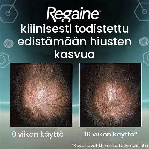 Regaine Minoksidiilivaahto 5 % miehille