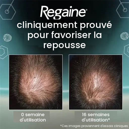 Regaine Mousse Minoxidil 5% pour Hommes