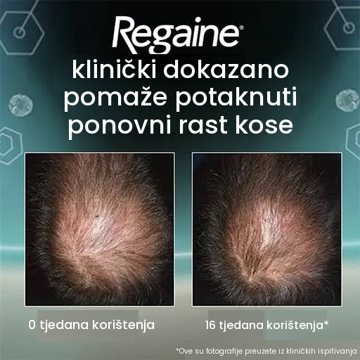Regaine Minoxidil pjena 5% za muškarce - zaliha za 9 mjeseci