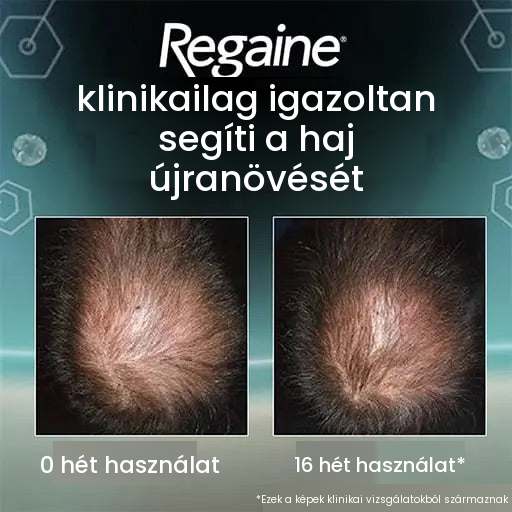 Regaine Minoxidil hab 5% férfiaknak - 6 havi adag