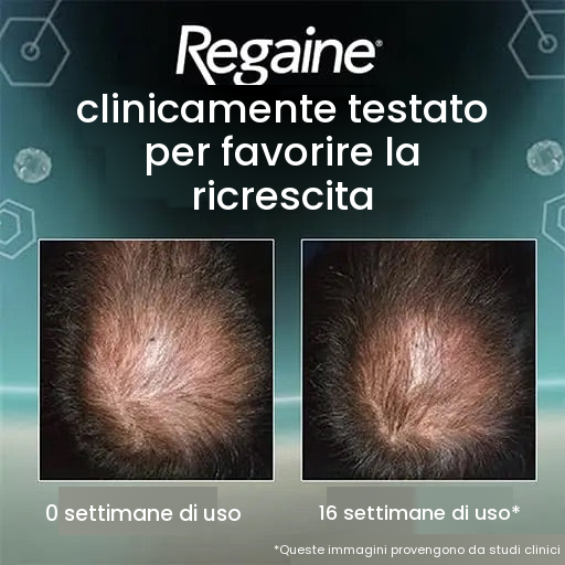Regaine Schiuma Minoxidil 5% per Uomo