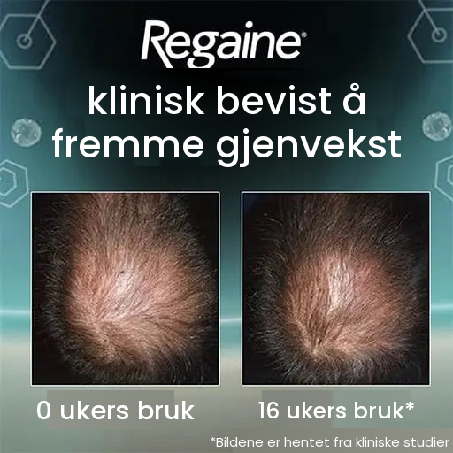 Regaine minoksidil-skum 5 % for menn – 9 måneders forbruk