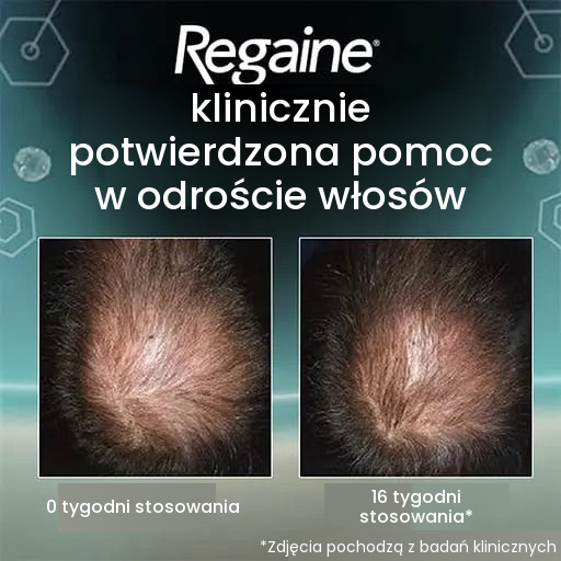Regaine Pianka z Minoksydylem 5% dla Mężczyzn
