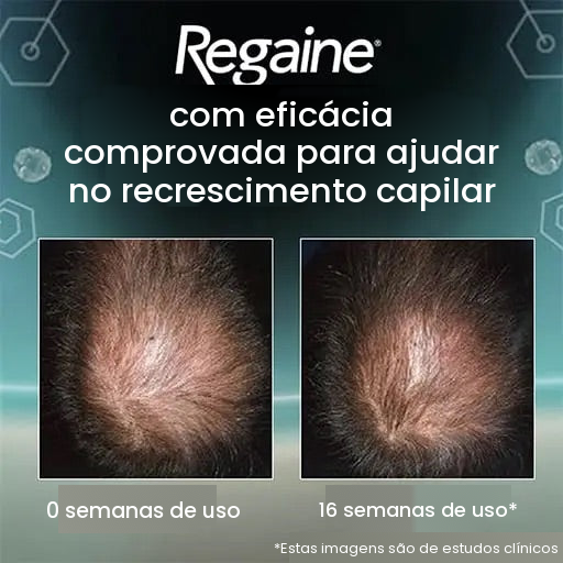 Espuma de Minoxidil Regaine 5% para Homens