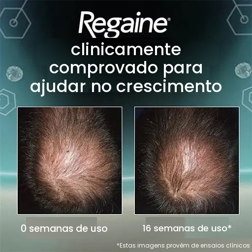 Regaine Minoxidil Espuma 5% para Homens - Suprimento para 9 Meses