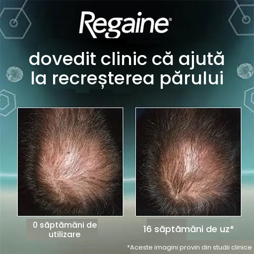 Spumă Regaine Minoxidil 5% pentru bărbați - rezervă pentru 12 luni