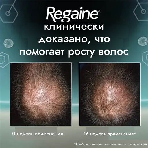 Regaine пена с миноксидилом 5% для мужчин — запас на 12 месяцев