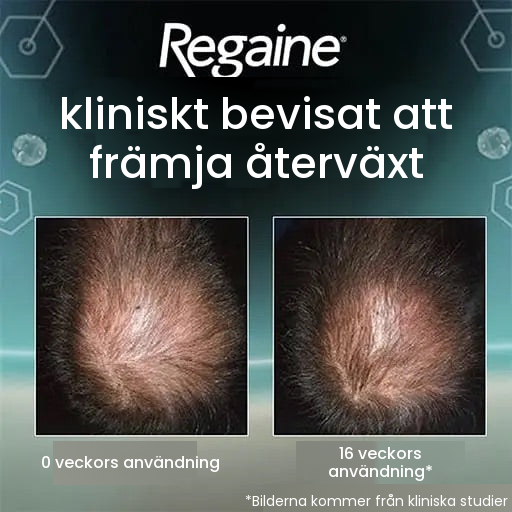 Regaine Minoxidilskum 5% för män