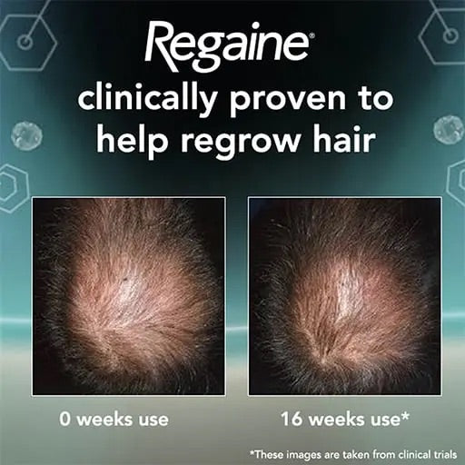 Regaine Schiuma Minoxidil 5% per Uomo – Scorta per 6 Mesi
