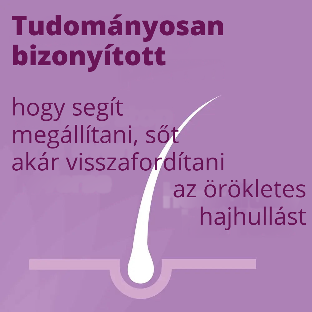 Regaine Minoxidil Oldat 2% nőknek - 12 havi adag