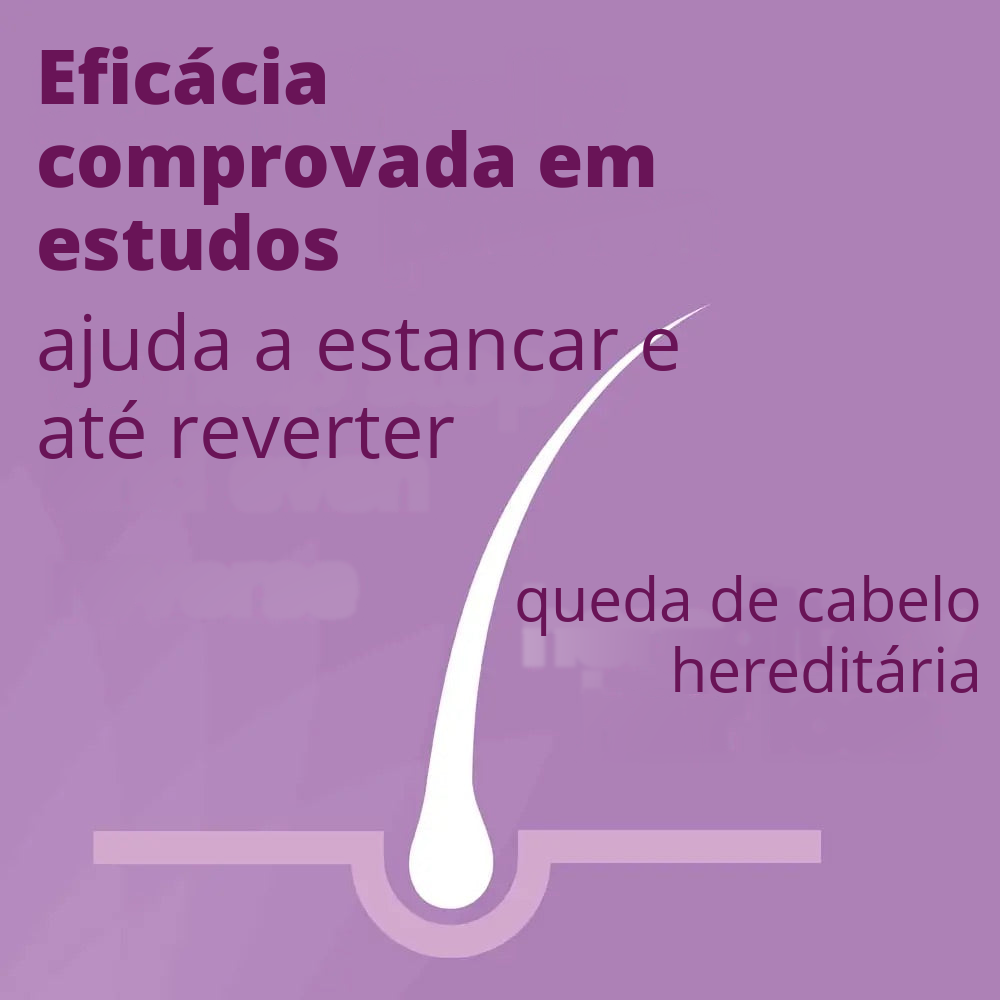 Loção de Minoxidil Regaine 2% para Mulheres - Suprimento para 12 Meses