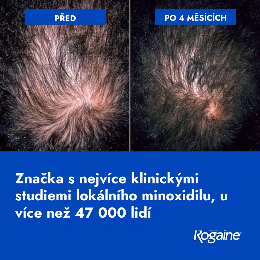 Rogaine Minoxidil Foam 5% for Men