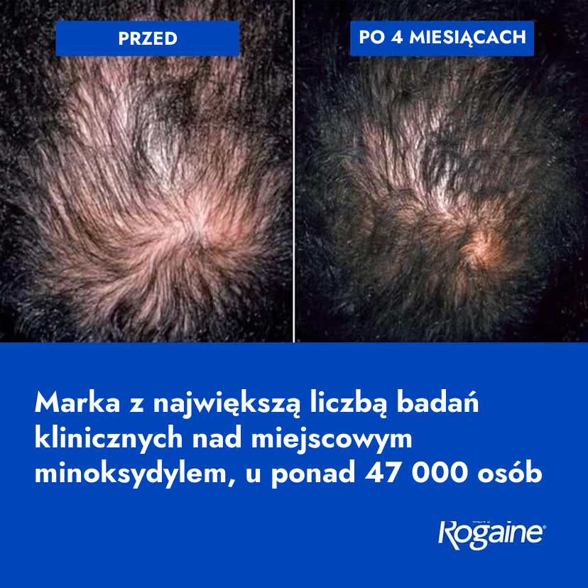 Rogaine Minoxidil Foam 5% for Men
