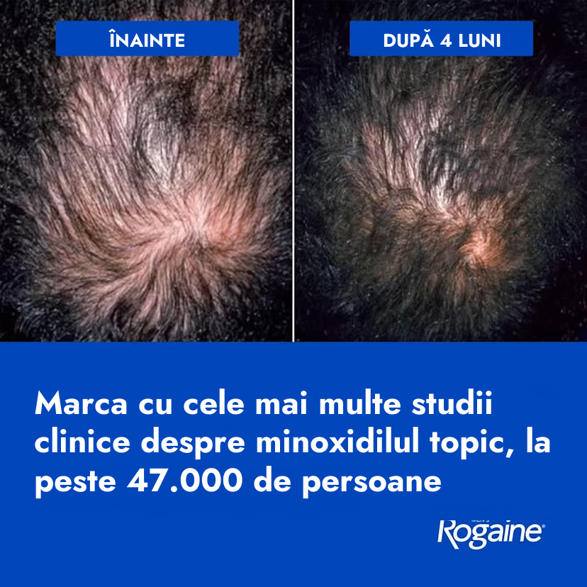Rogaine Minoxidil Foam 5% for Men