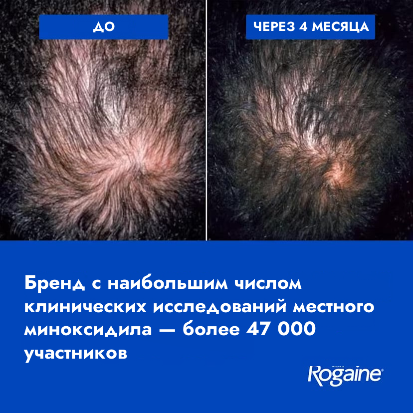 Пена Rogaine с миноксидилом 5% для мужчин