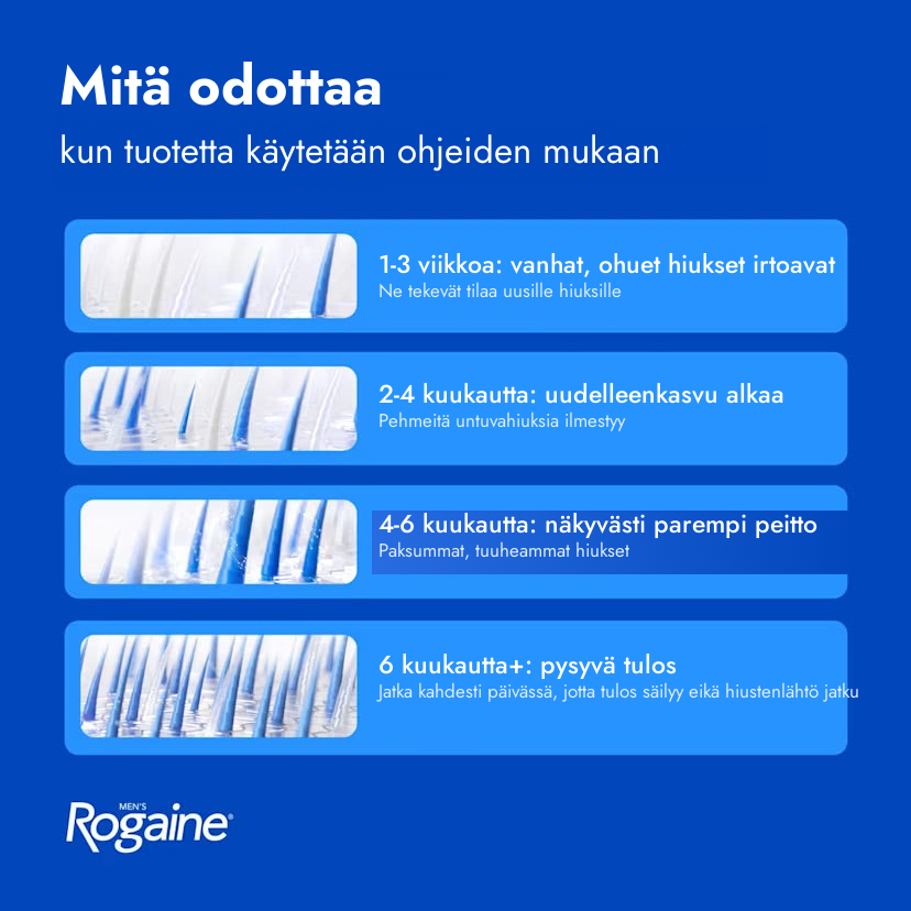 Rogaine Minoxidil Foam 5% miehille – mitä odottaa