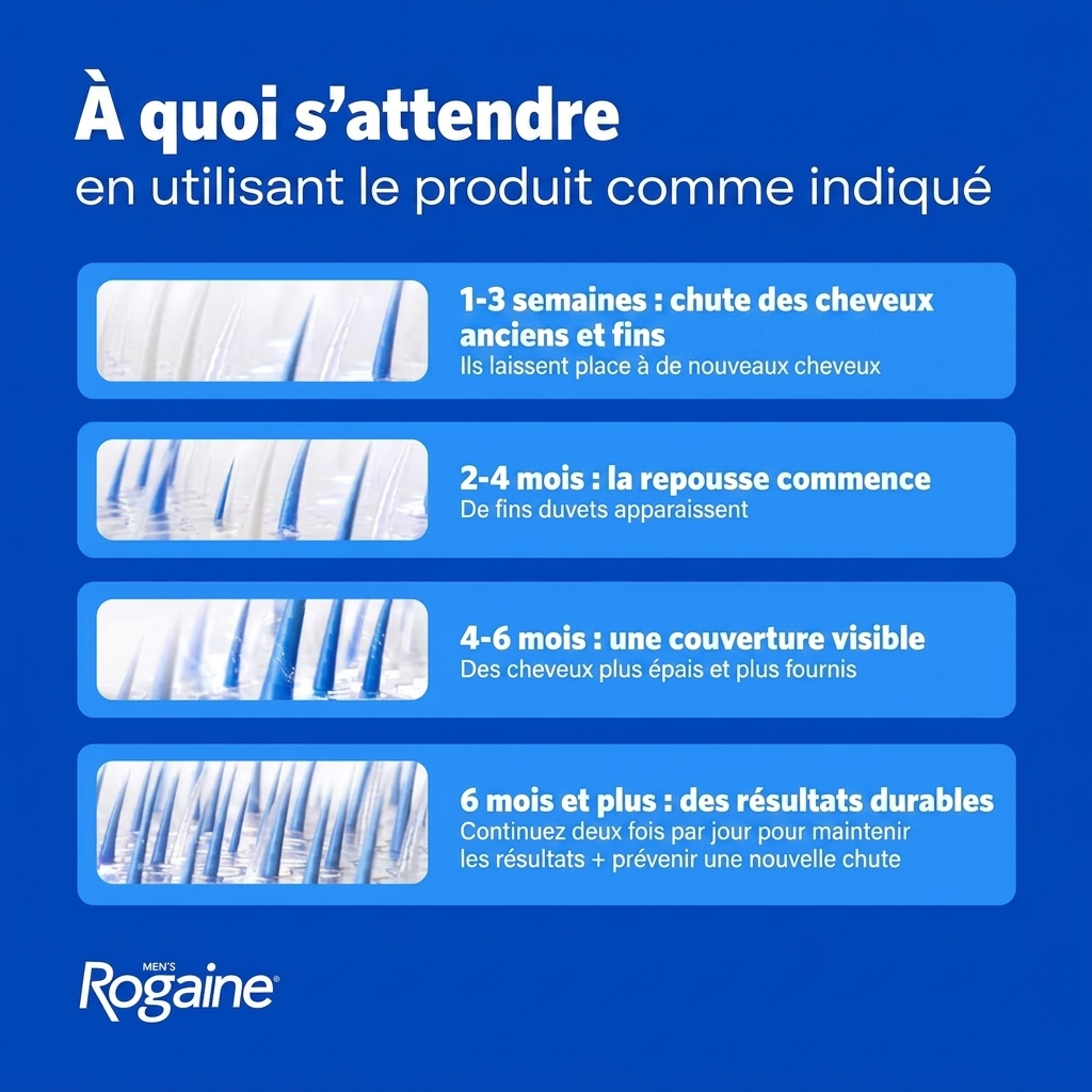 Rogaine Mousse Minoxidil 5% pour Hommes - à quoi s'attendre