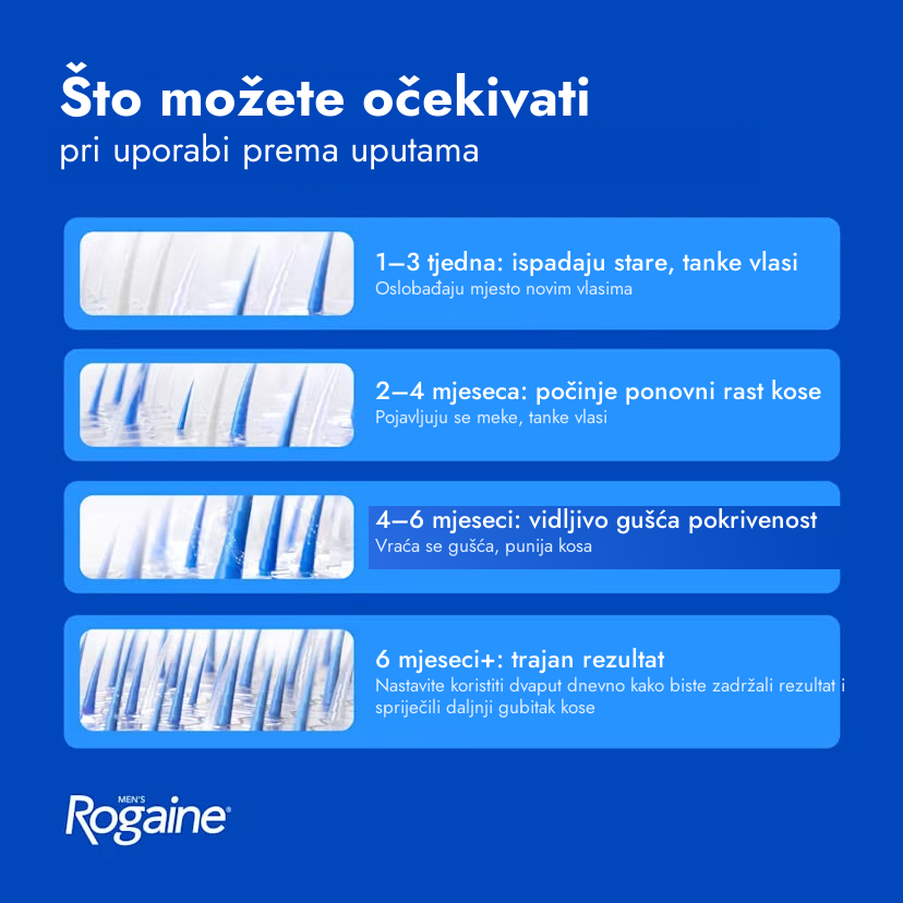 Rogaine minoksidil pjena 5% za muškarce - što možete očekivati