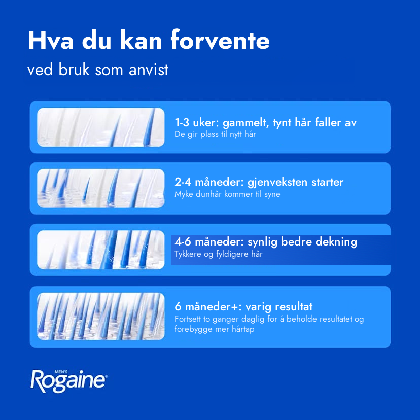 Rogaine Minoxidil skum 5% for menn – hva du kan forvente