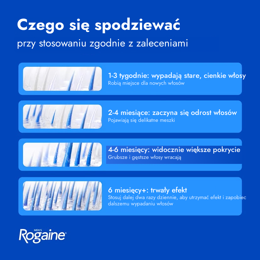 Rogaine Pianka z minoksydylem 5% dla mężczyzn – czego się spodziewać