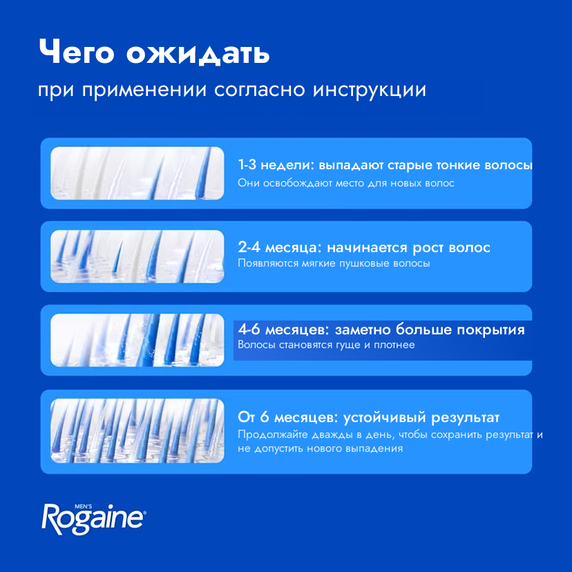 Пена Rogaine с миноксидилом 5% для мужчин — чего ожидать