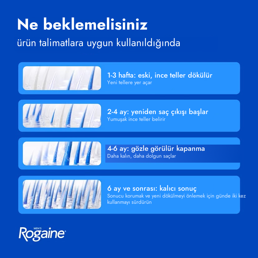 Rogaine Minoxidil Foam 5% for Men - ne beklemeli