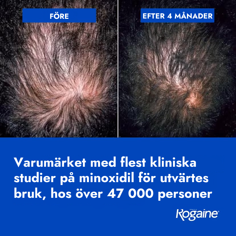 Rogaine Minoxidil Lotion 5% for Men