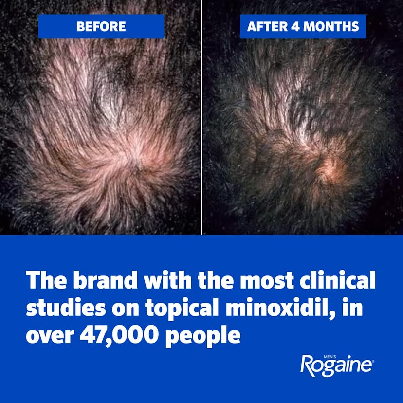 Rogaine Minoxidil Lotion 5% for Men