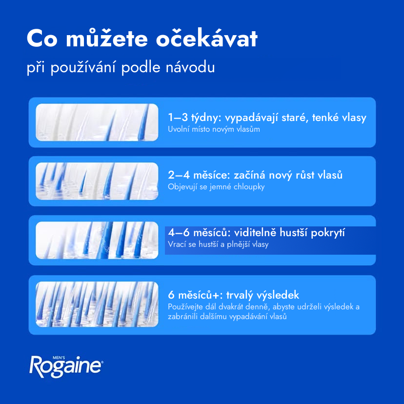 Rogaine Minoxidil roztok 5% pro muže – co očekávat