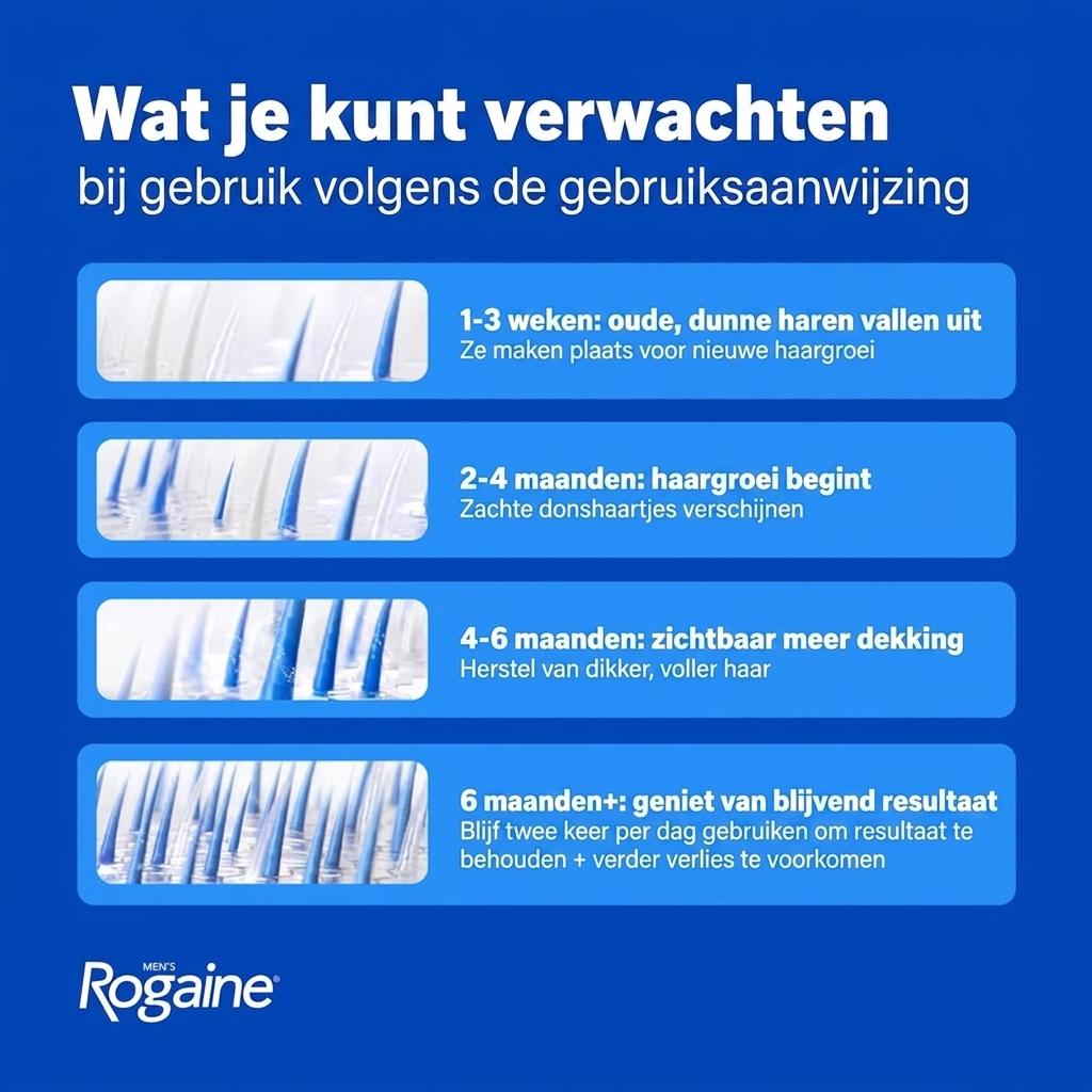 Rogaine Minoxidil Lotion 5% voor Mannen - wat je kunt verwachten