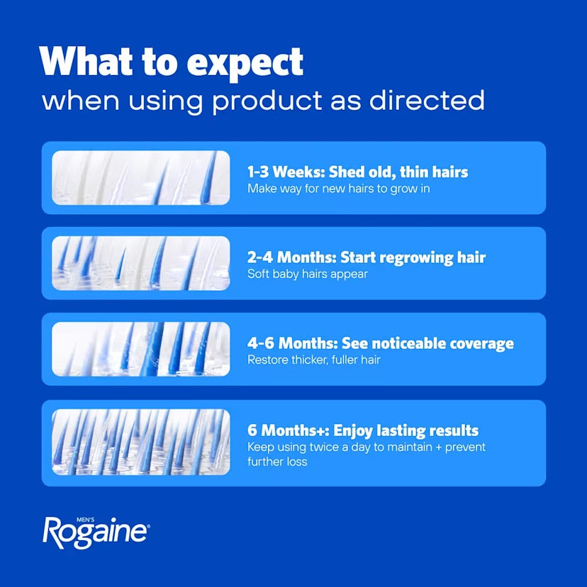 Rogaine Minoxidil Lotion 5% for Men - what to expect