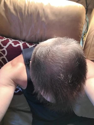 After, Regaine user