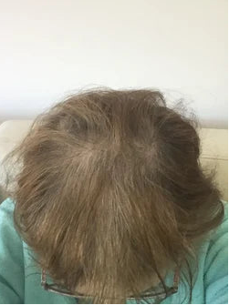 Ena, Austria - AFTER