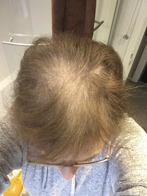 Ena, Austria - BEFORE