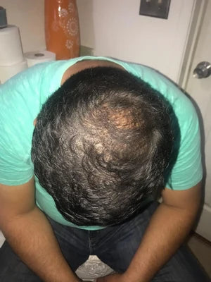 Ahmed, France - BEFORE