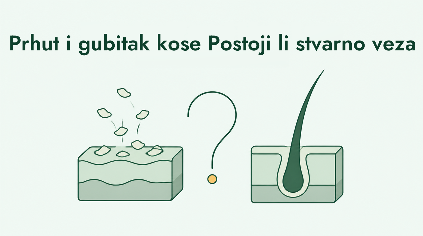 Uzrokuje li prhut gubitak kose