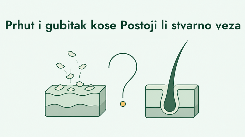Uzrokuje li prhut gubitak kose