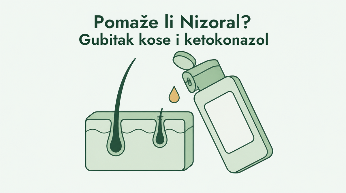 Pomaže li Nizoral kod gubitka kose