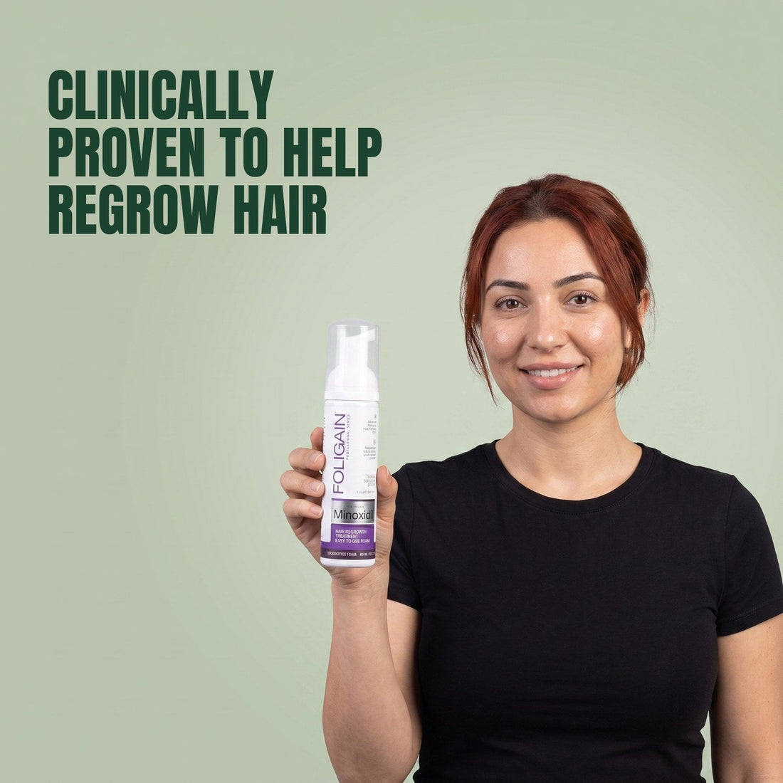 Foligain Minoxidil hab 2% nőknek - 6 havi adag — termékcsomagolás fehér háttéren