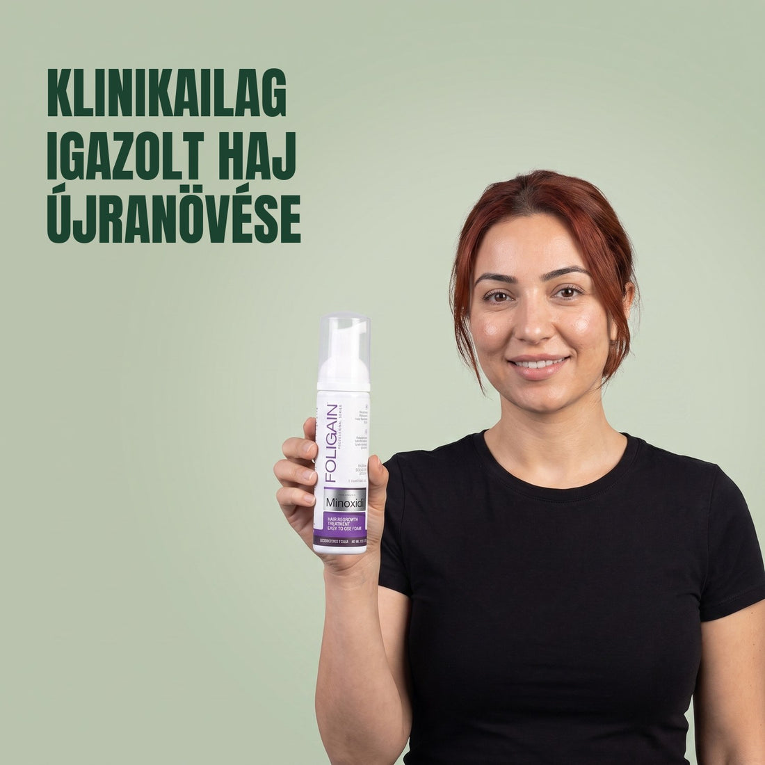 Foligain Minoxidil hab 2% nőknek - 6 havi adag — termékcsomagolás fehér háttéren